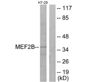 Western Blot - Anti-MEF2B Antibody (C10843) - Antibodies.com