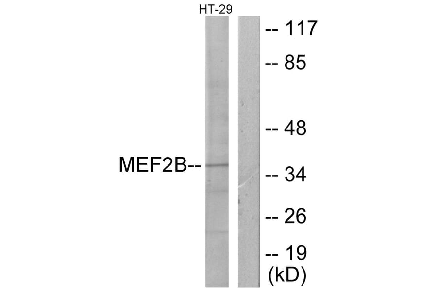 Western Blot - Anti-MEF2B Antibody (C10843) - Antibodies.com