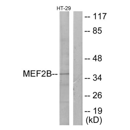 Western Blot - Anti-MEF2B Antibody (C10843) - Antibodies.com