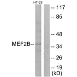 Western Blot - Anti-MEF2B Antibody (C10843) - Antibodies.com