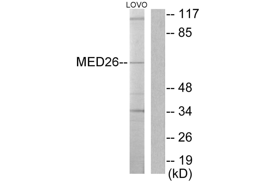 Western Blot - Anti-MED26 Antibody (C10228) - Antibodies.com