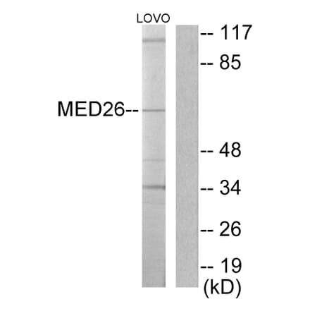 Western Blot - Anti-MED26 Antibody (C10228) - Antibodies.com