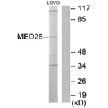 Western Blot - Anti-MED26 Antibody (C10228) - Antibodies.com