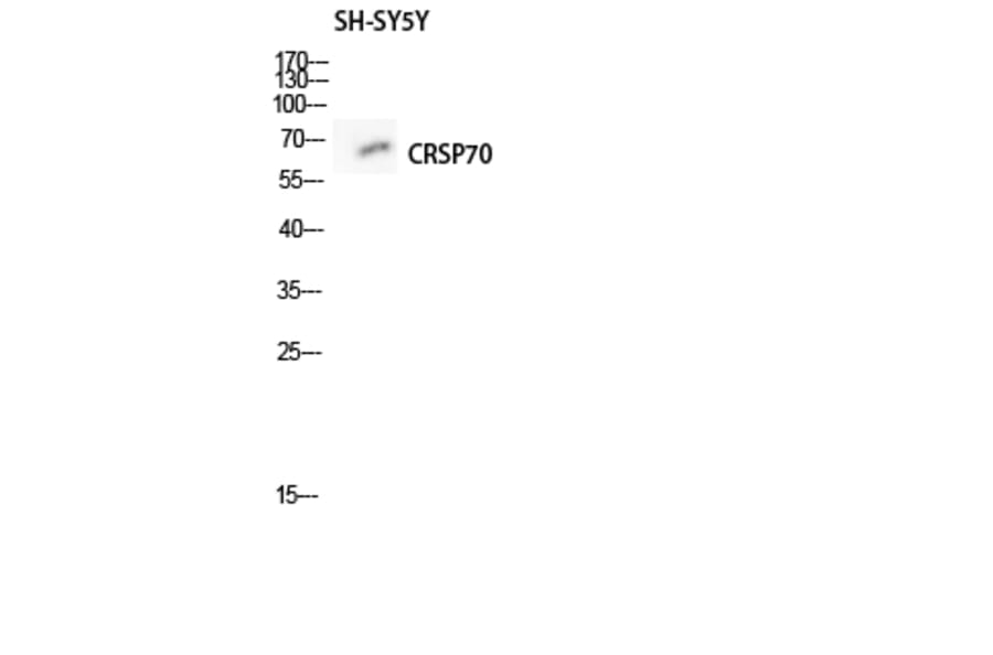 Western Blot - Anti-MED26 Antibody (C10228) - Antibodies.com