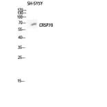 Western Blot - Anti-MED26 Antibody (C10228) - Antibodies.com