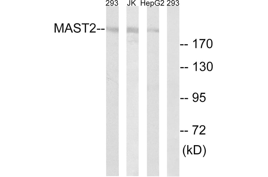 Western Blot - Anti-MAST2 Antibody (C11224) - Antibodies.com