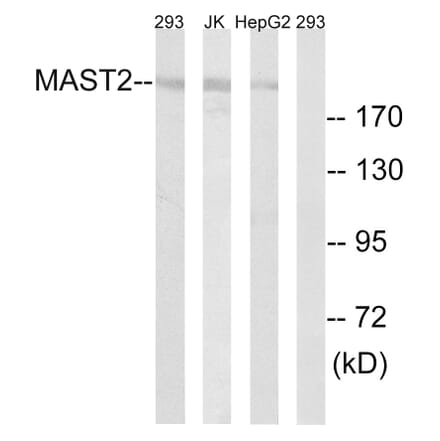 Western Blot - Anti-MAST2 Antibody (C11224) - Antibodies.com