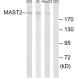 Western Blot - Anti-MAST2 Antibody (C11224) - Antibodies.com