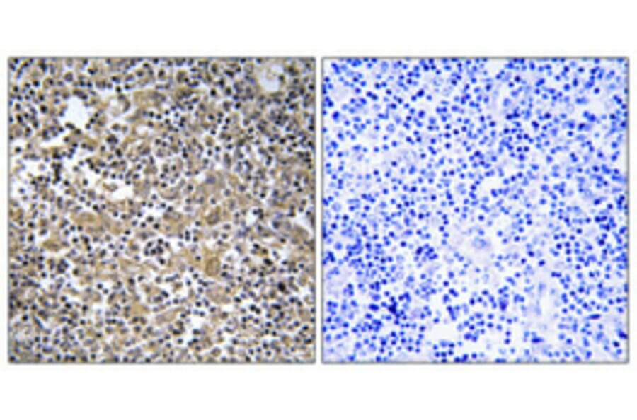 Immunohistochemistry - Anti-MAST2 Antibody (C11224) - Antibodies.com