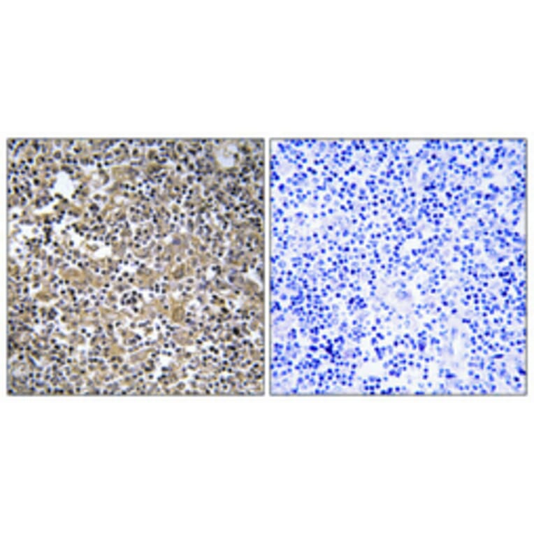 Immunohistochemistry - Anti-MAST2 Antibody (C11224) - Antibodies.com