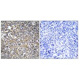 Immunohistochemistry - Anti-MAST2 Antibody (C11224) - Antibodies.com