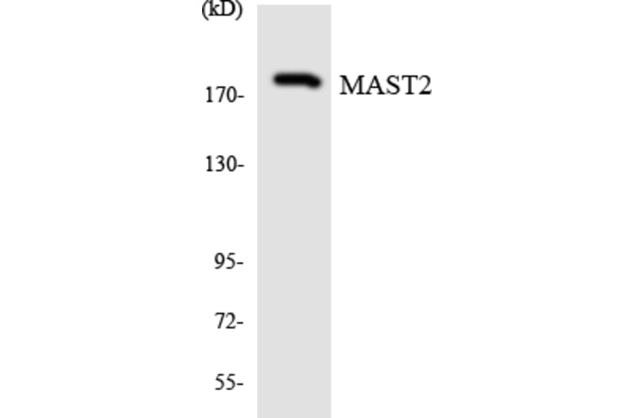 Western Blot - Anti-MAST2 Antibody (R12-3000) - Antibodies.com