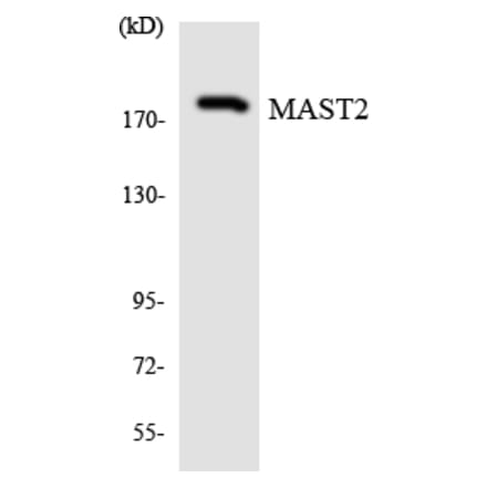 Western Blot - Anti-MAST2 Antibody (R12-3000) - Antibodies.com