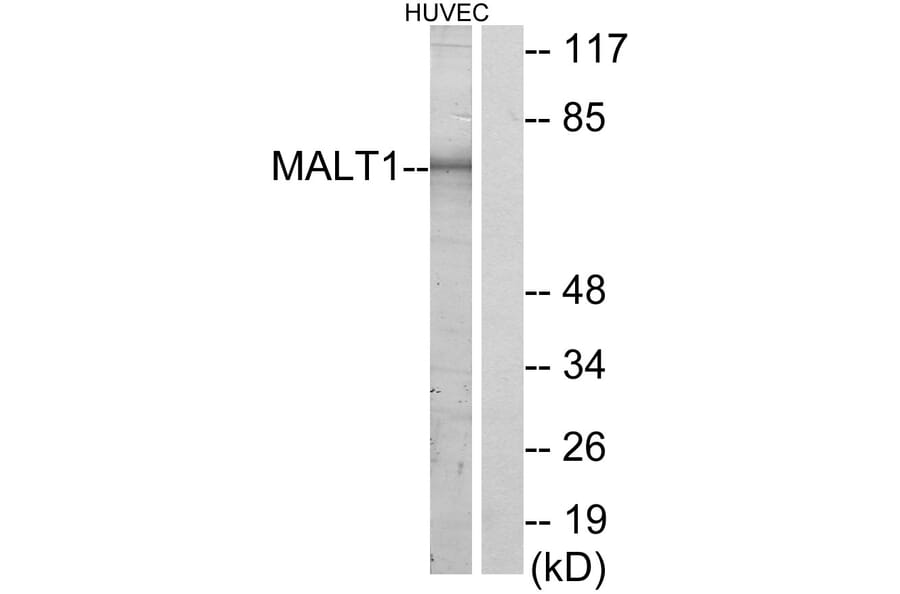 Western Blot - Anti-MALT1 Antibody (C13082) - Antibodies.com