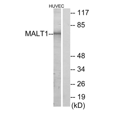 Western Blot - Anti-MALT1 Antibody (C13082) - Antibodies.com