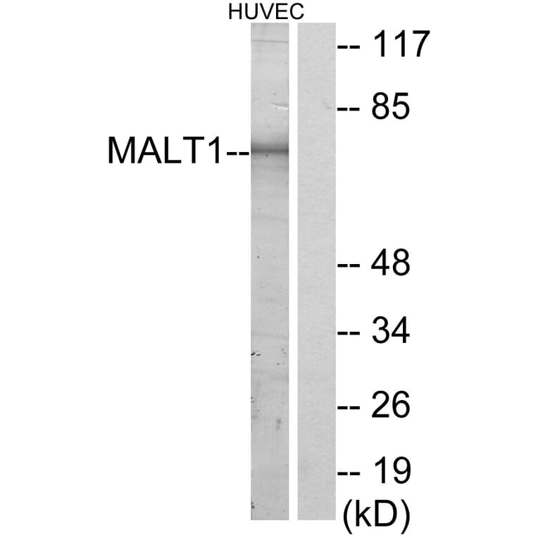 Western Blot - Anti-MALT1 Antibody (C13082) - Antibodies.com