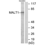 Western Blot - Anti-MALT1 Antibody (C13082) - Antibodies.com