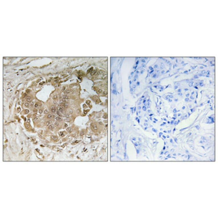 Immunohistochemistry - Anti-MALT1 Antibody (C13082) - Antibodies.com