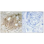 Immunohistochemistry - Anti-MALT1 Antibody (C13082) - Antibodies.com