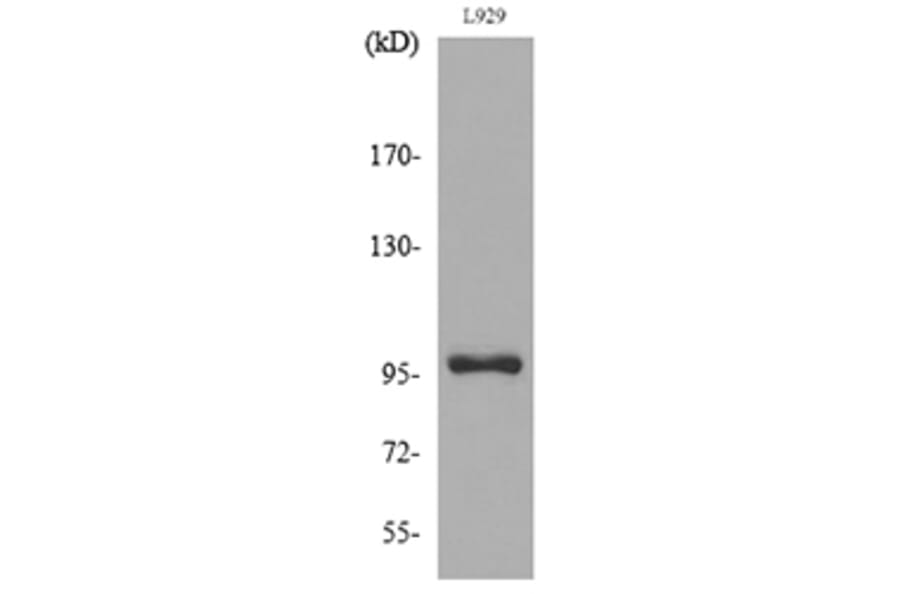 Western Blot - Anti-MACC1 Antibody (C30591) - Antibodies.com