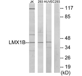 Western Blot - Anti-LMX1B Antibody (C10143) - Antibodies.com