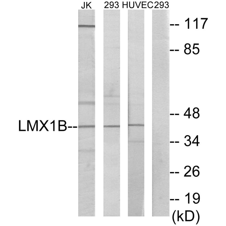 Western Blot - Anti-LMX1B Antibody (C10143) - Antibodies.com