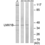 Western Blot - Anti-LMX1B Antibody (C10143) - Antibodies.com