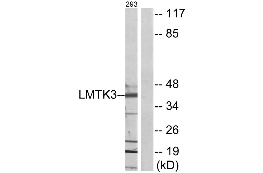 Western Blot - Anti-LMTK3 Antibody (C11528) - Antibodies.com