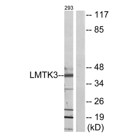 Western Blot - Anti-LMTK3 Antibody (C11528) - Antibodies.com