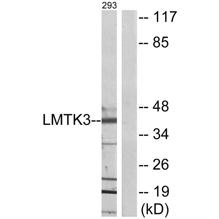 Western Blot - Anti-LMTK3 Antibody (C11528) - Antibodies.com