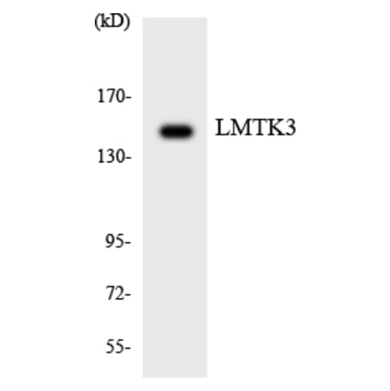 Western Blot - Anti-LMTK3 Antibody (R12-2974) - Antibodies.com