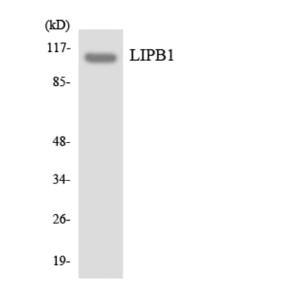 Western Blot - Anti-LIPB1 Antibody (R12-2969) - Antibodies.com