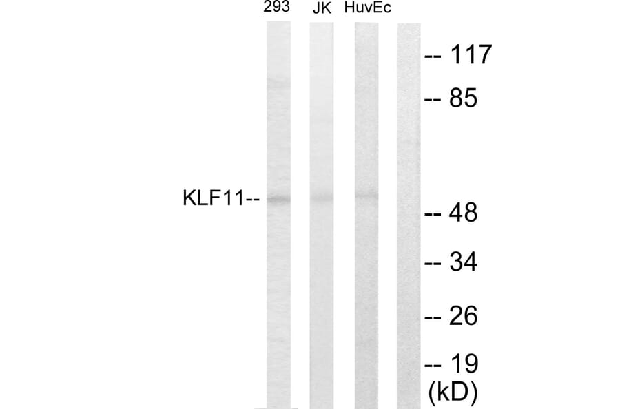 Western Blot - Anti-KLF11 Antibody (C10058) - Antibodies.com