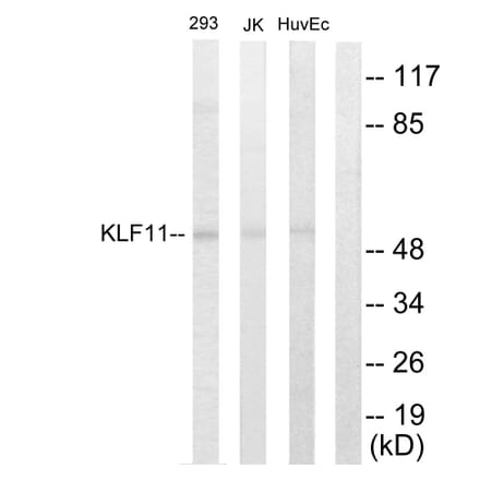 Western Blot - Anti-KLF11 Antibody (C10058) - Antibodies.com