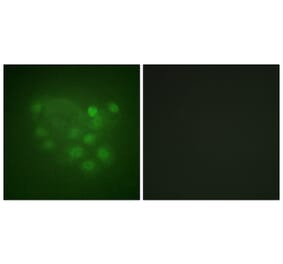 Immunofluorescence - Anti-KIF2C Antibody (B1214) - Antibodies.com