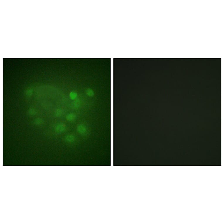 Immunofluorescence - Anti-KIF2C Antibody (B1214) - Antibodies.com