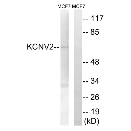 Western Blot - Anti-KCNV2 Antibody (C17829) - Antibodies.com