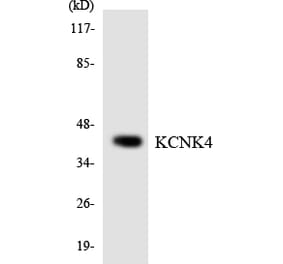 Western Blot - Anti-KCNK4 Antibody (R12-2947) - Antibodies.com