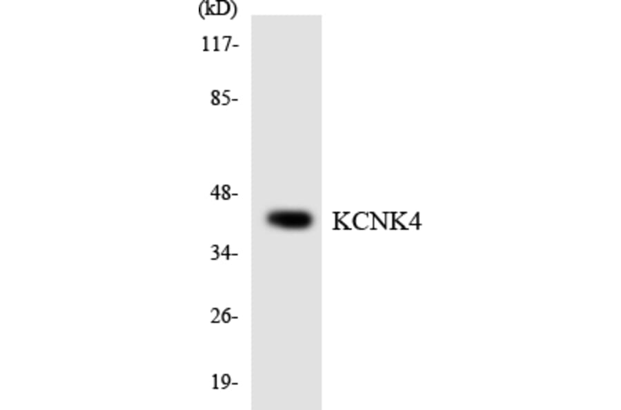 Western Blot - Anti-KCNK4 Antibody (R12-2947) - Antibodies.com