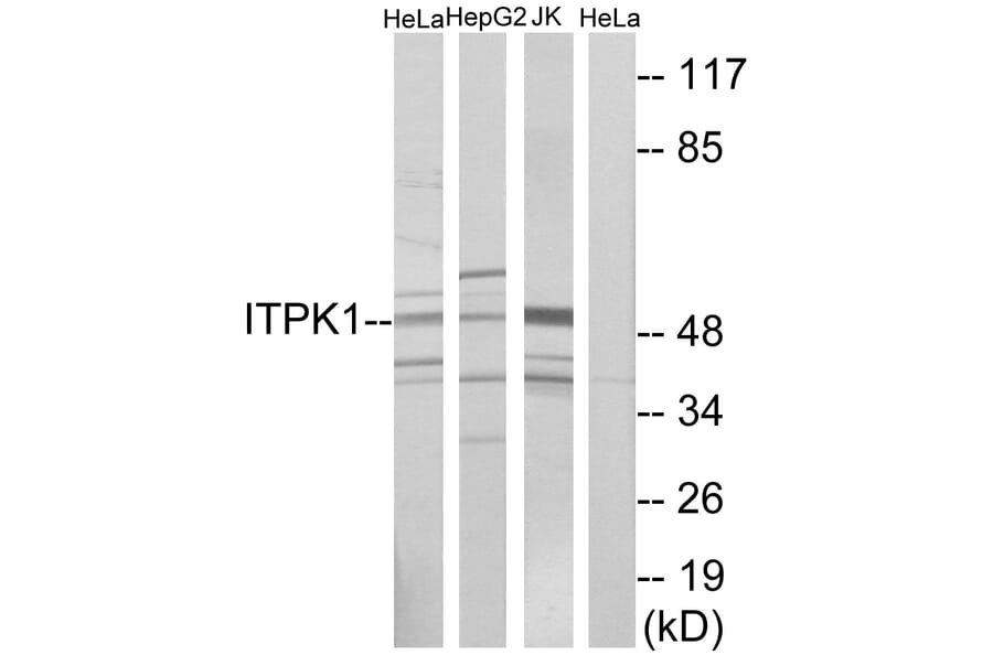 Western Blot - Anti-ITPK1 Antibody (C10997) - Antibodies.com