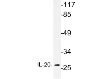 Western Blot - Anti-IL-20 Antibody (R12-2206) - Antibodies.com