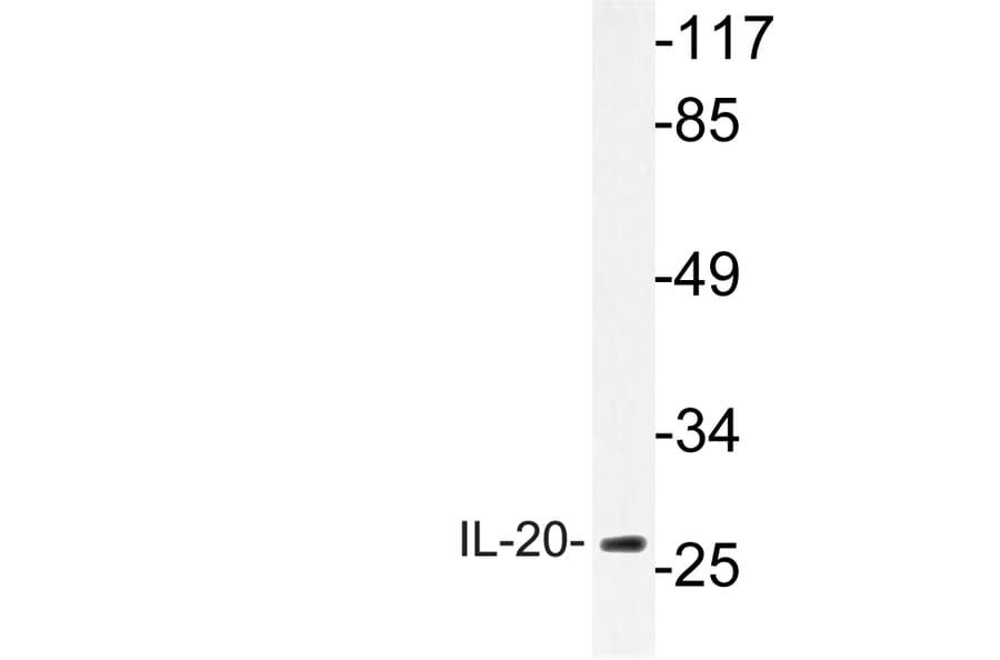 Western Blot - Anti-IL-20 Antibody (R12-2206) - Antibodies.com