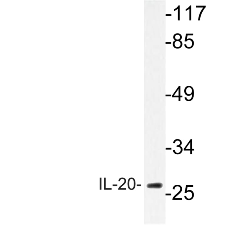 Western Blot - Anti-IL-20 Antibody (R12-2206) - Antibodies.com