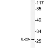 Western Blot - Anti-IL-20 Antibody (R12-2206) - Antibodies.com