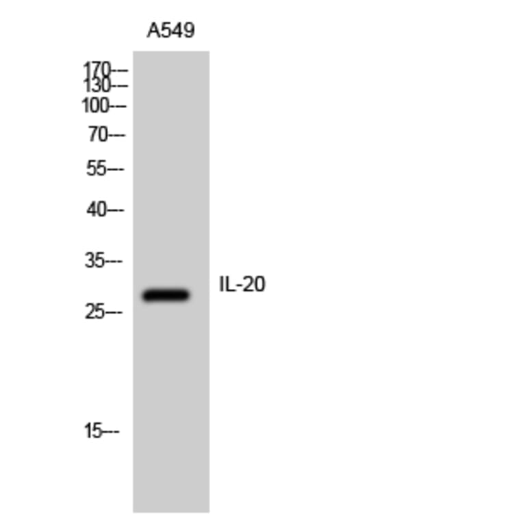 Western Blot - Anti-IL-20 Antibody (R12-2206) - Antibodies.com