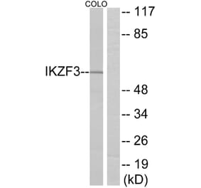 Western Blot - Anti-IKZF3 Antibody (C11873) - Antibodies.com
