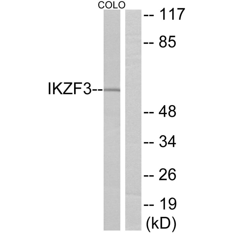 Western Blot - Anti-IKZF3 Antibody (C11873) - Antibodies.com