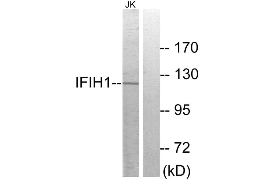 Western Blot - Anti-IFIH1 Antibody (C11646) - Antibodies.com