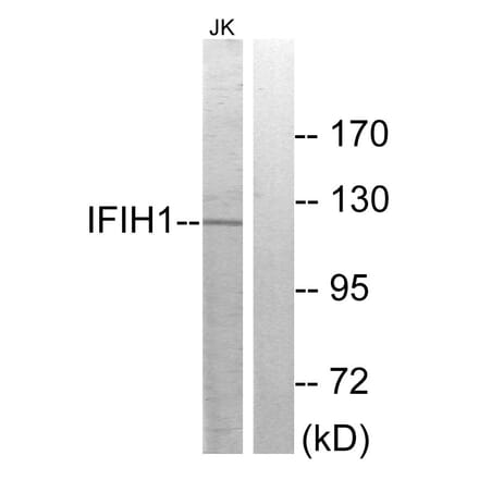 Western Blot - Anti-IFIH1 Antibody (C11646) - Antibodies.com