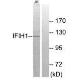 Western Blot - Anti-IFIH1 Antibody (C11646) - Antibodies.com